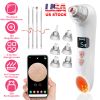 PoreVision Smart Skin Analyzer