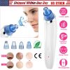 ClearSkin Pore Extractor